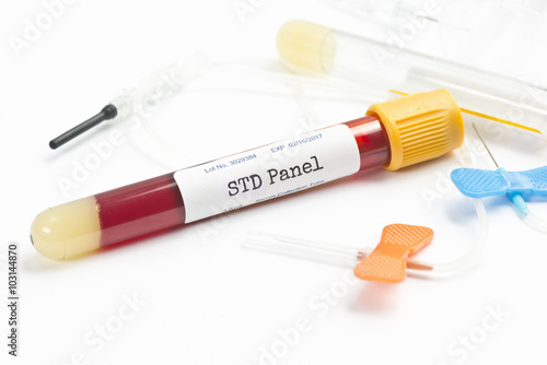 Slika na platnu STD Testing