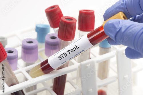 STD Testing