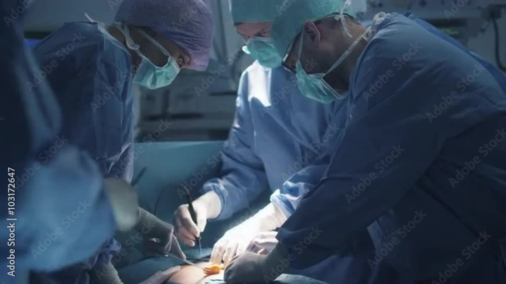 Medical Team Performing Surgical Operation in Modern Operating Room. Shot on RED Cinema Camera. Medical Team Performing Surgical Operation in Modern Operating Room. Shot on RED Cinema Camera.
