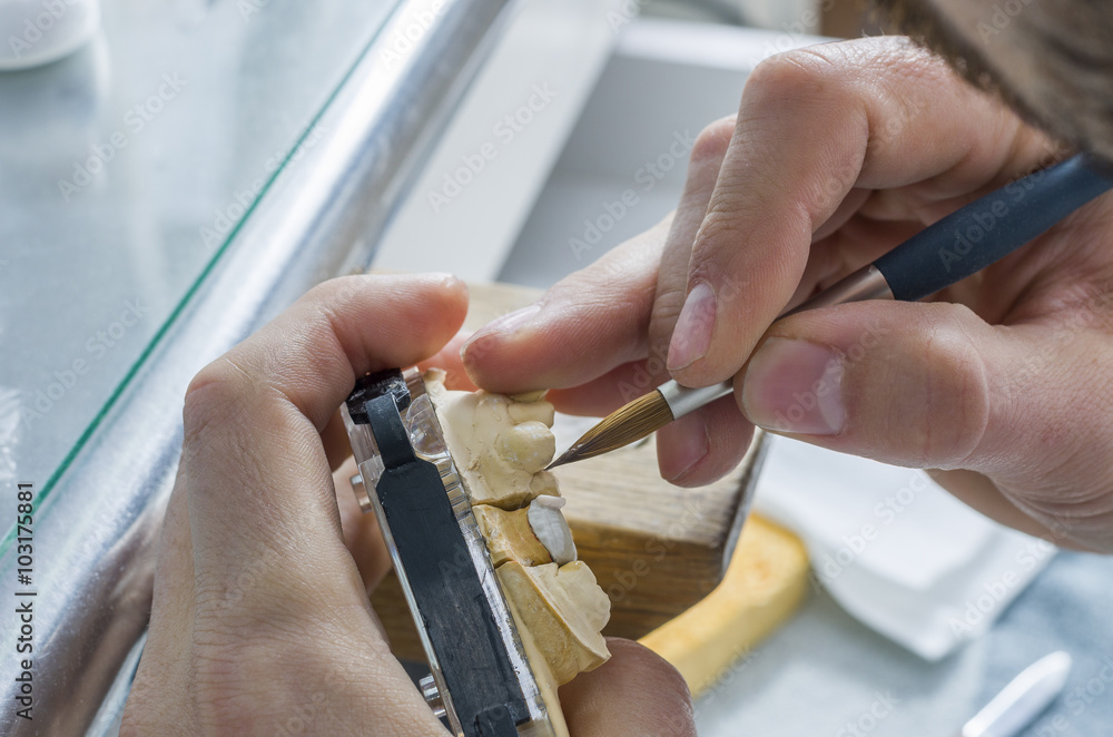 Dental technician applying ceramics to teeth in the dental model