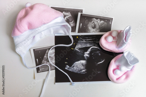 Many ultrasound pictures and clothes for baby girl. Expecting in pregnancy concept.