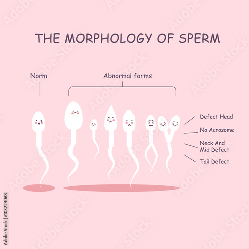 The morphology of the sperm