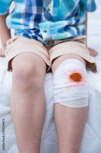 Child injured. Wound on the child's knee with bandage.