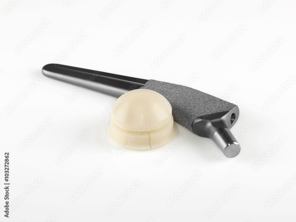 Titanium alloy hip joint replacement or artificial hip Stock Photo