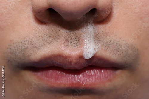 Canvas Print running nose of sick man