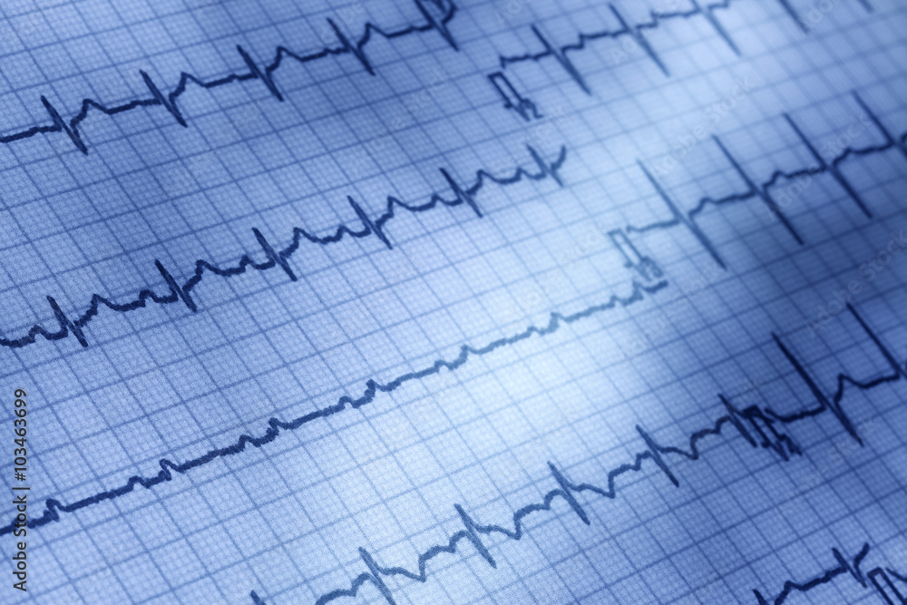 Naklejka premium 医療イメージ/心電図