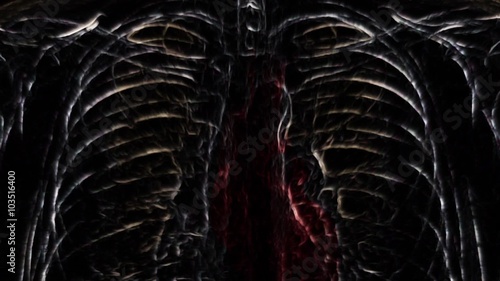 Dark radiograph of irradiated body. (loop ready file)