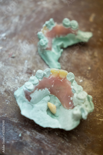 set of dentures. False teeth