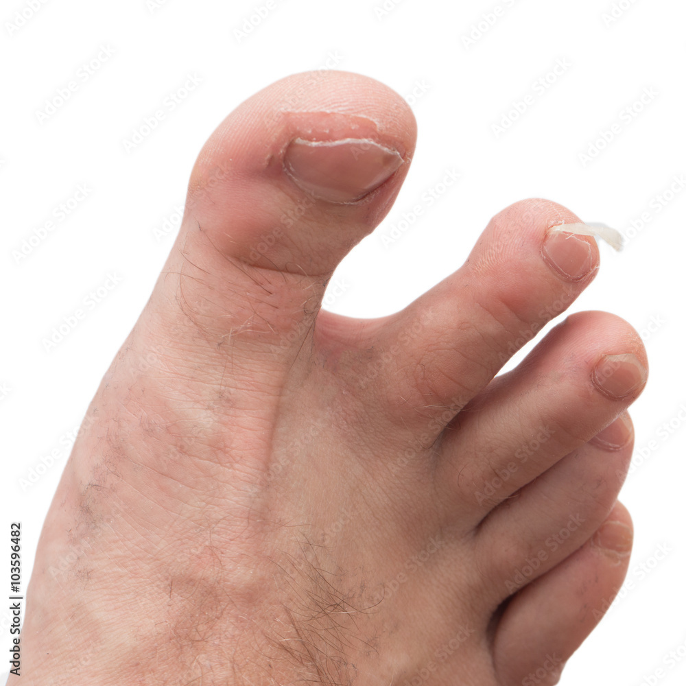 male pedicure