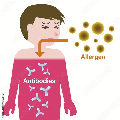 Allergen and antibodies, Mechanism of developing an allergy , vector illustration