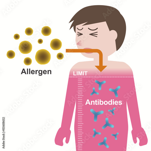 Allergen and antibodies, Mechanism of developing an allergy , vector illustration