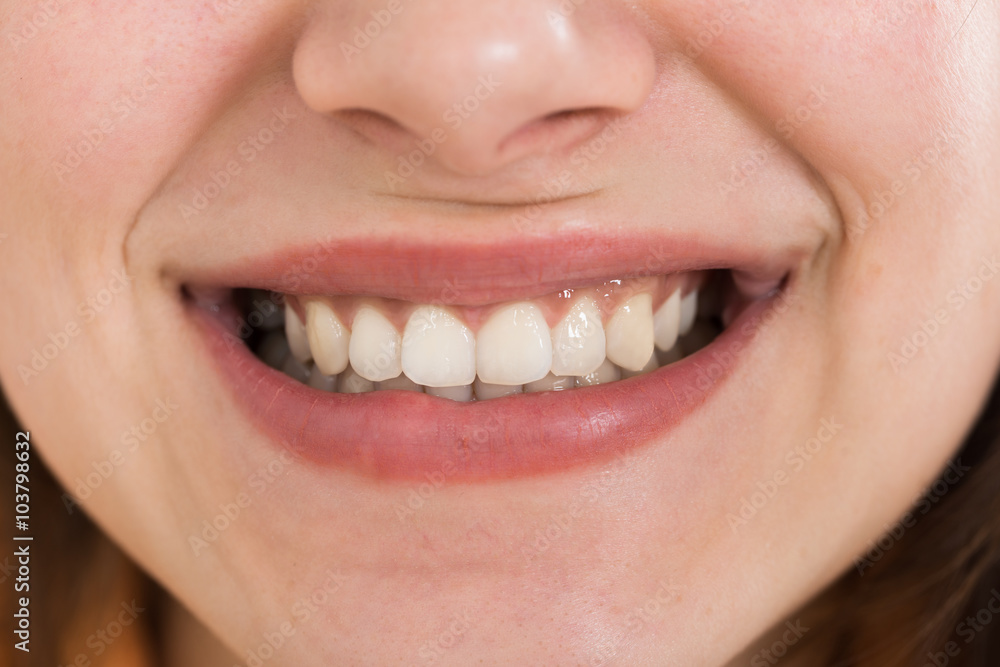 Female Smiling With Healthy White Teeth Female Smiling With Healthy White Teeth