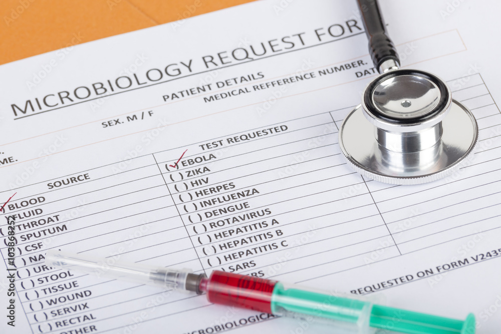 Microbiological blood test results show positive for Ebola virus Microbiological blood test results show positive for Ebola virus