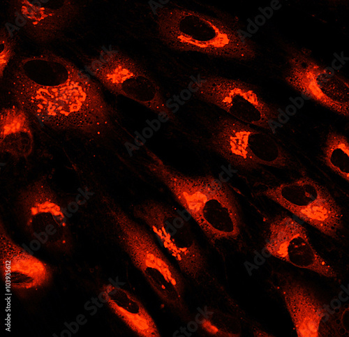 Mesenchymal stem cells labeled with fluorescent molecules