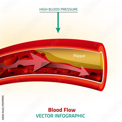Blood Vector Image