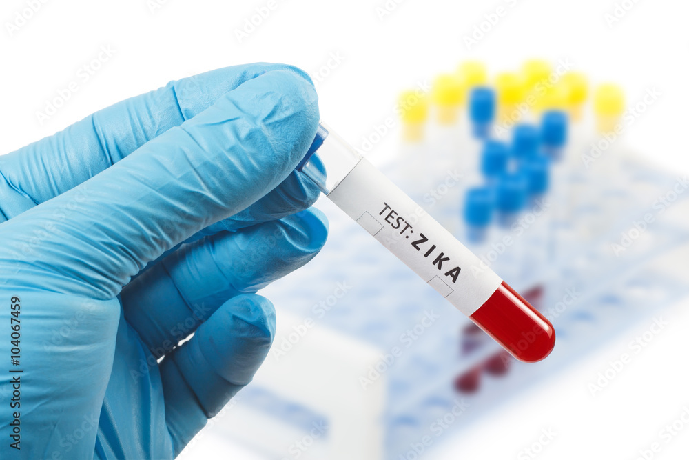 Zika. Blood test Zika. Blood test