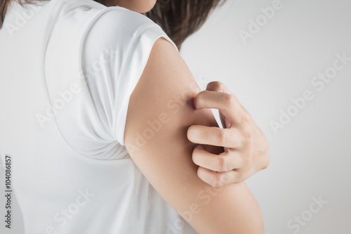 Woman scratching her arm.