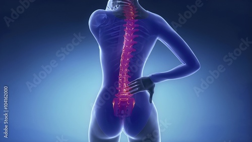 Female backbone injury pain - spine hurt concept photo