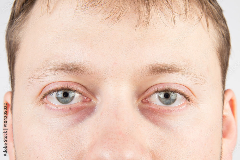 Naklejka premium Man's tired eyes