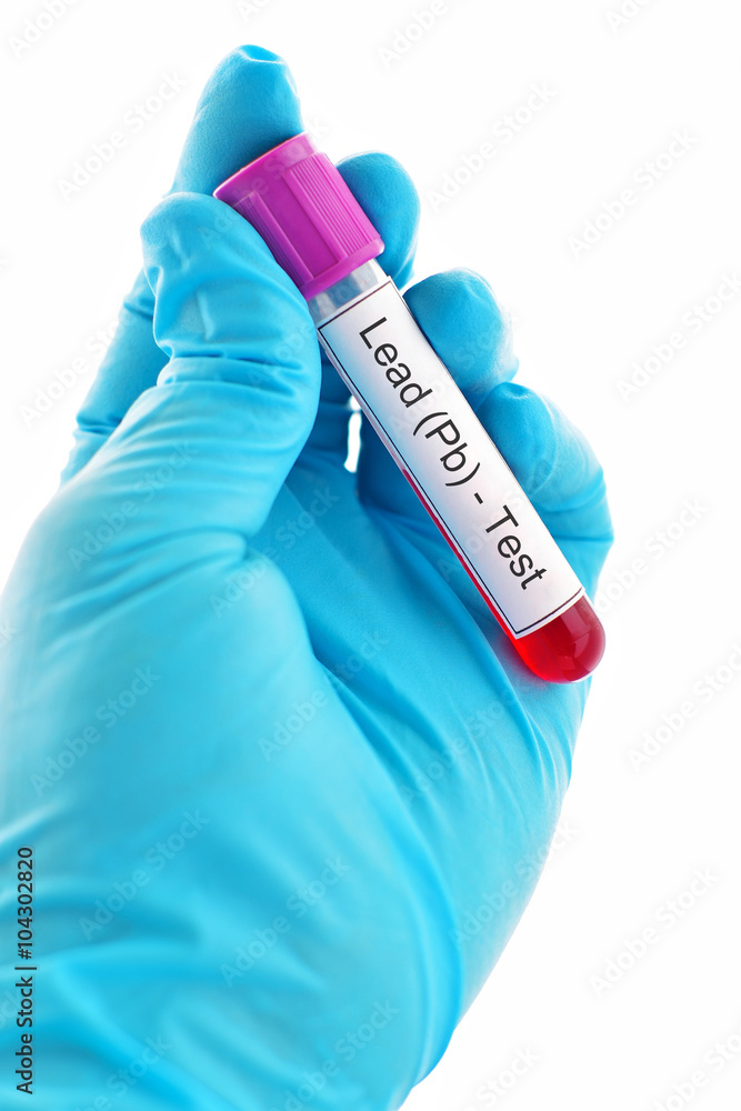 Fototapeta premium Blood for lead metal test