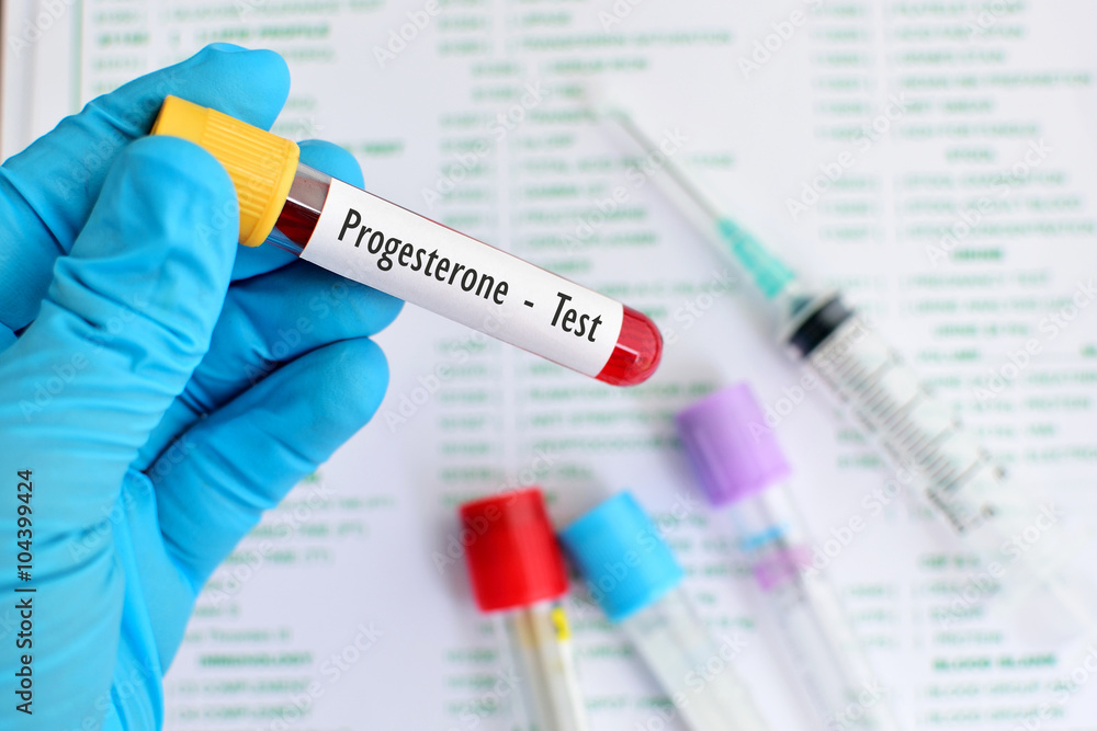 Progesterone hormone test
Progesterone hormone test