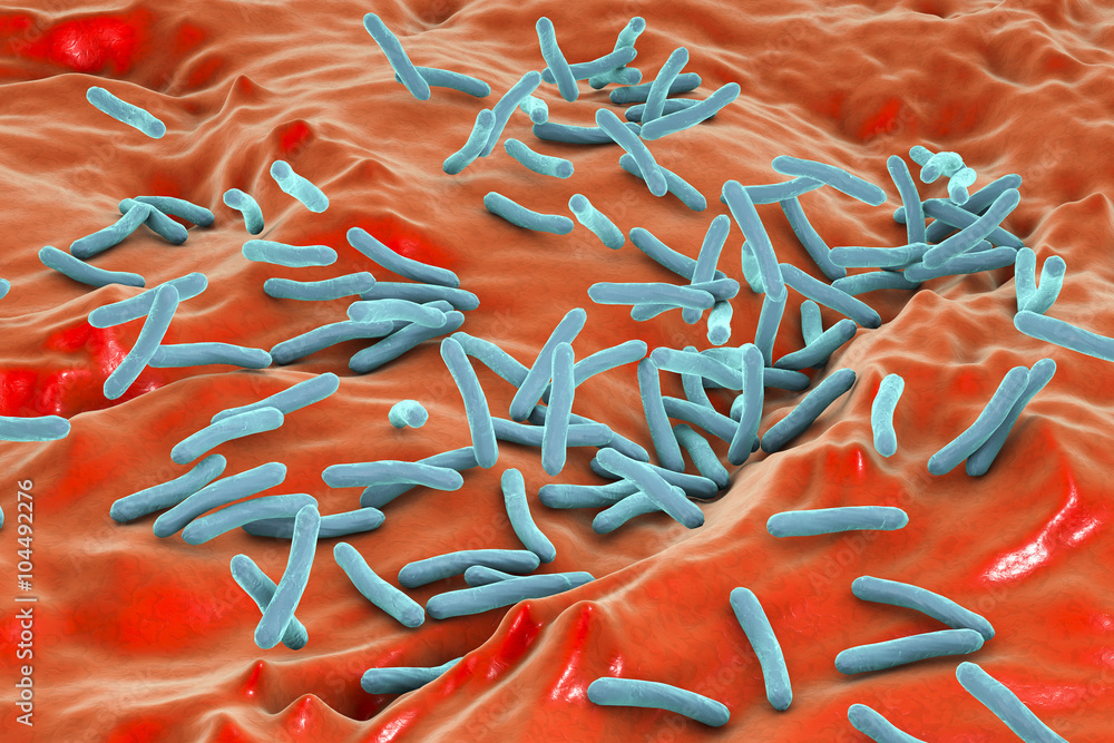 Upbringing aspect Moist Microscopic view of bacterium Mycobacterium tuberculosis inside human body,  model of bacteria, realistic illustration of microbes, microorganisms,  bacterium which causes tuberculosis Stock Illustration | Adobe Stock