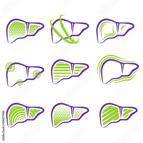 All About Liver - Diseases and Treatment