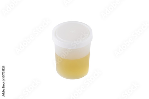 jar of urine photo