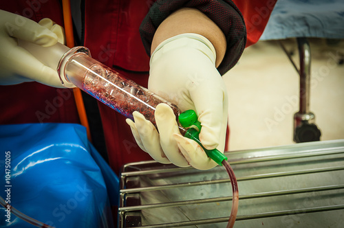 nasogastric tube use for treatment and diagnosis in upper gastrointestinal bleeding patient