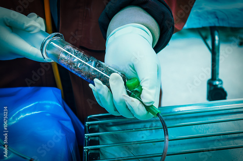 nasogastric tube use for treatment and diagnosis in upper gastrointestinal bleeding patient
