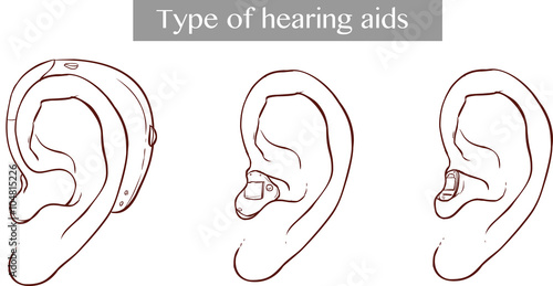  vector illustration of a Type of hearing aids
