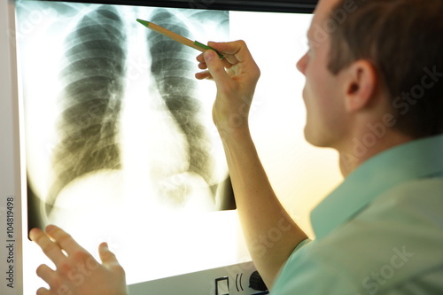 Photos specialist watching image of chest   at xray film viewer