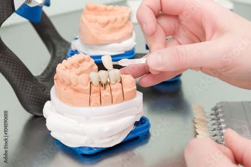Zahnfarbe eines Implantats wird im Dentallabor geprüft