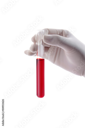 Hand holding a bottle of blood sample