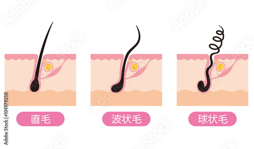 毛根の種類 くせ毛 Stock イラスト Adobe Stock 毛根の種類 くせ毛 Stock イラスト Adobe Stock