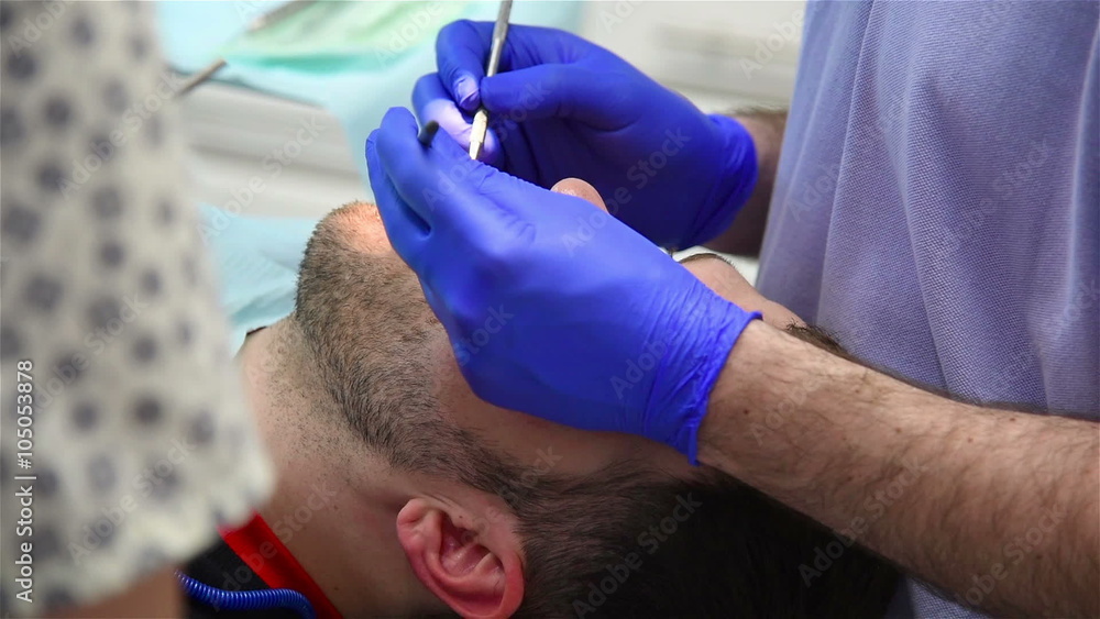 Dentist Removes Tooth Decay In Mouth Of Patient Dentist Removes Tooth Decay In Mouth Of Patient