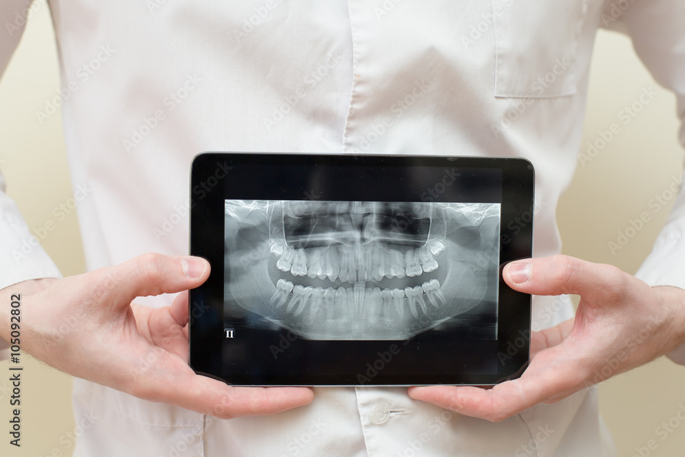 x ray tablet dental Stock Photo Adobe Stock