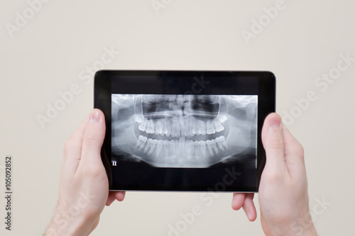 x ray tablet dental