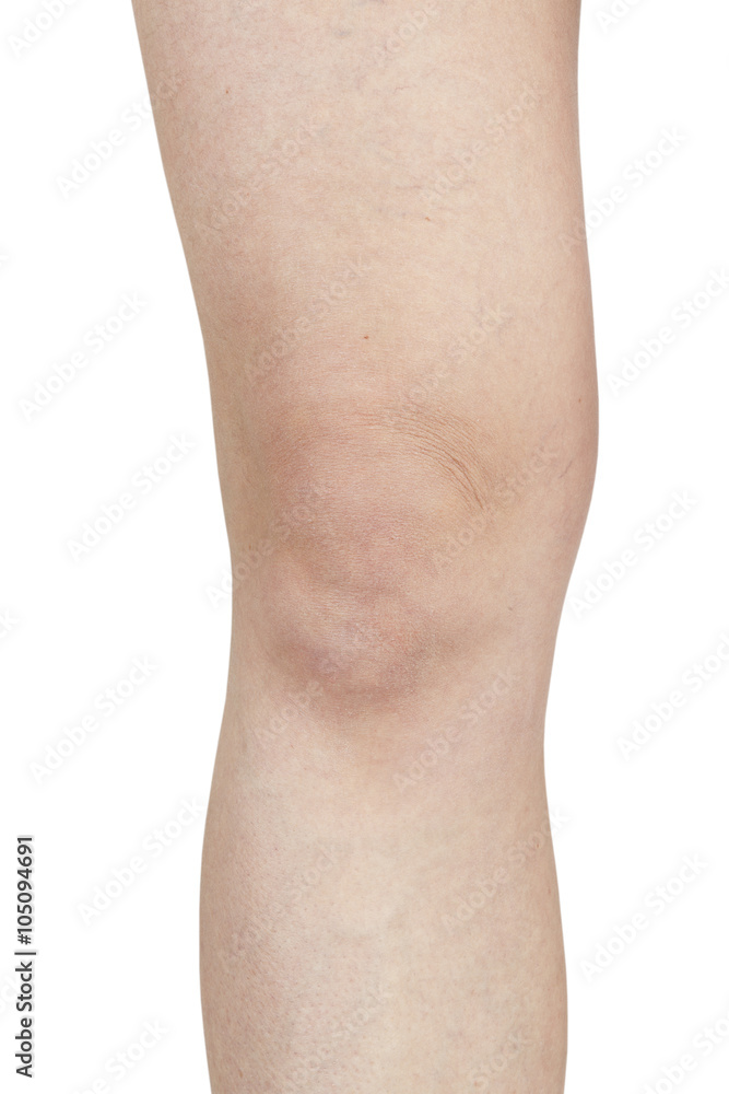 Elbow female legs