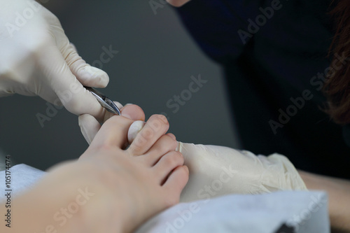 Pdicure cuticle removing with forceps in white gloves