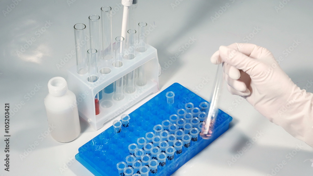 Lab technician scientist performs medical clinic chemical analysis and diagnostics using test tube phial and pipette. 4K UHD video footage. Lab technician scientist performs medical clinic chemical analysis and diagnostics using test tube phial and pipette. 4K UHD video footage.
