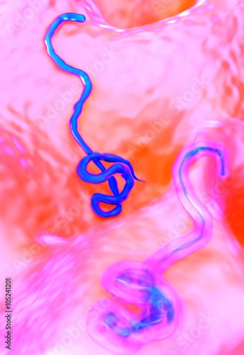ebola virus
