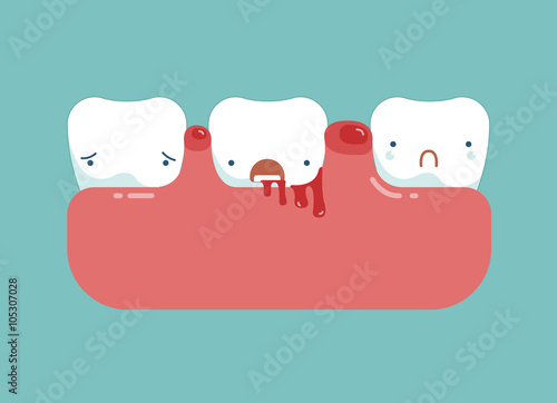 Gingivitis and blood ,dental concept photo