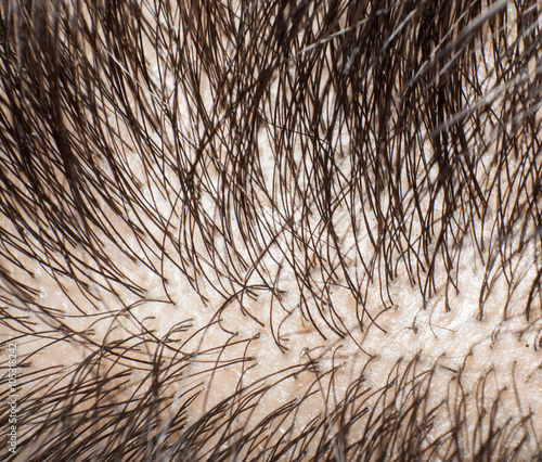 Closeup head with hair and scalp