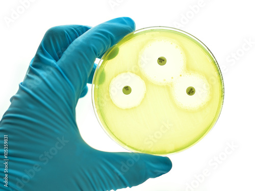 Antimicrobial susceptibility testing in culture medium plate
 photo