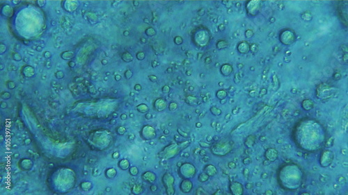 Yeast Fungi Organisms Under Microscope 100x