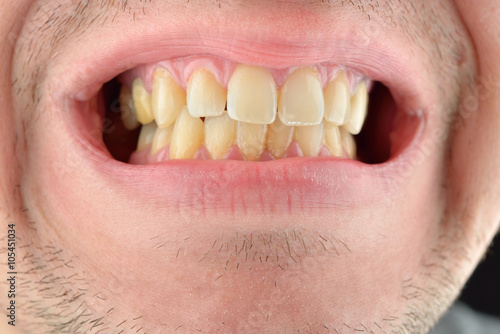 Detailed image of man showing his teeth. Dental health care. Hyg