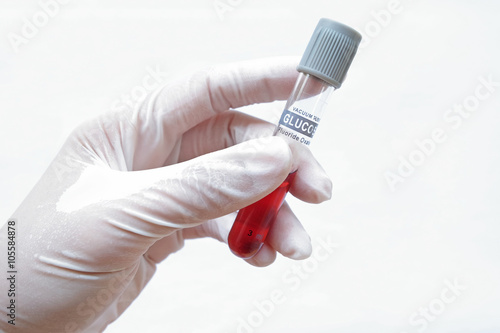 grey plastic stopper on blood collection tube,held by hand 