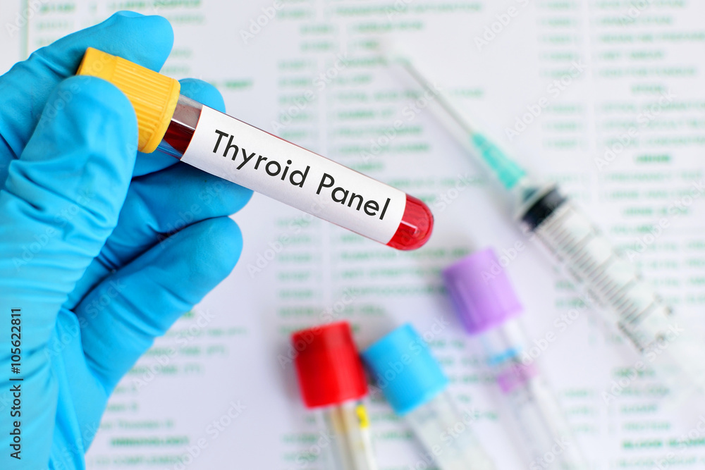 Blood sample for thyroid panel test
Blood sample for thyroid panel test