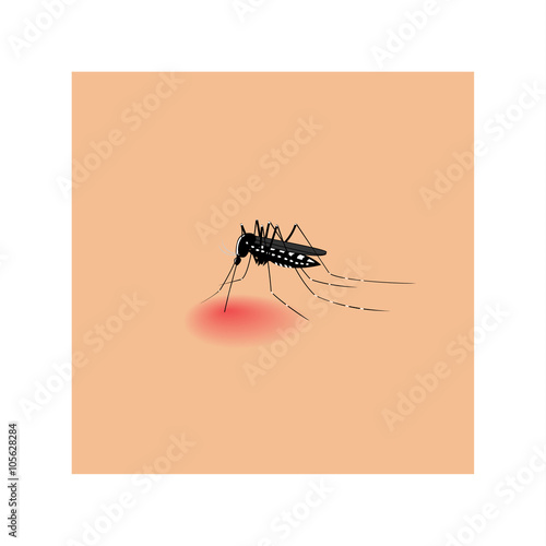 Vector image of a mosquito biting skin